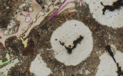 New Research Initiative on Microstructural Phase Identification Using Vision Transformers